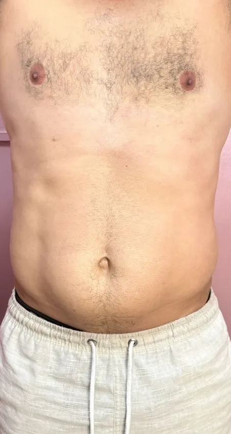 Criomodelagem, resultado real