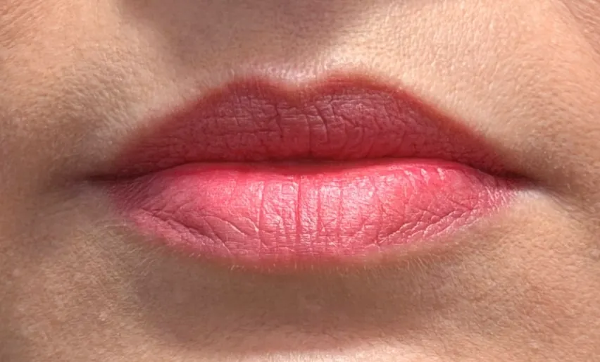 Preenchimento labial: Caso 04 · definição de contorno (antes)