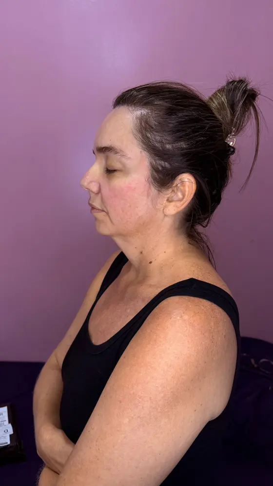 Avaliação de perfil 90°: terço inferior e pescoço